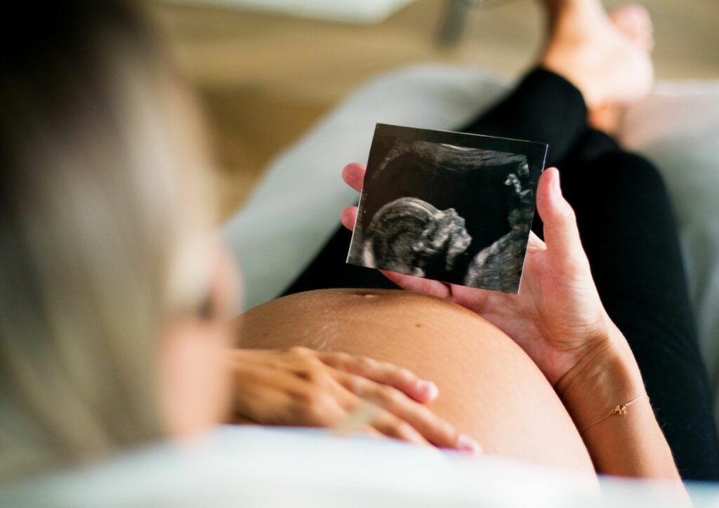 חשוב להכיר: 4 מקרים של רשלנות רפואית בלידה